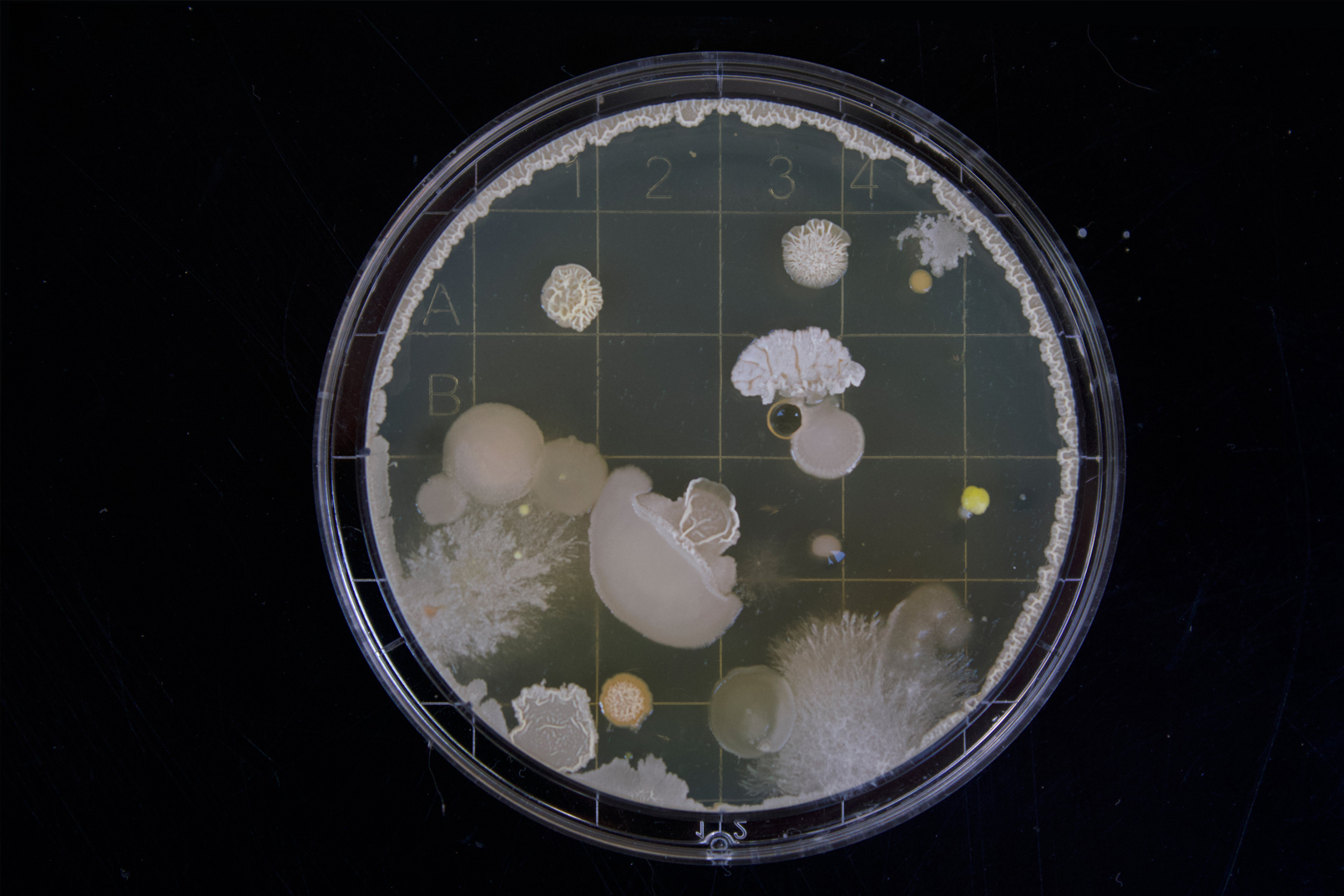 Virus under the microscope